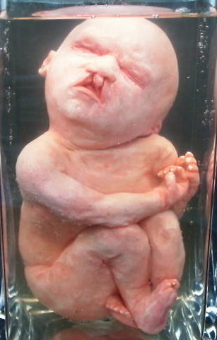 Baby fetus on ebay